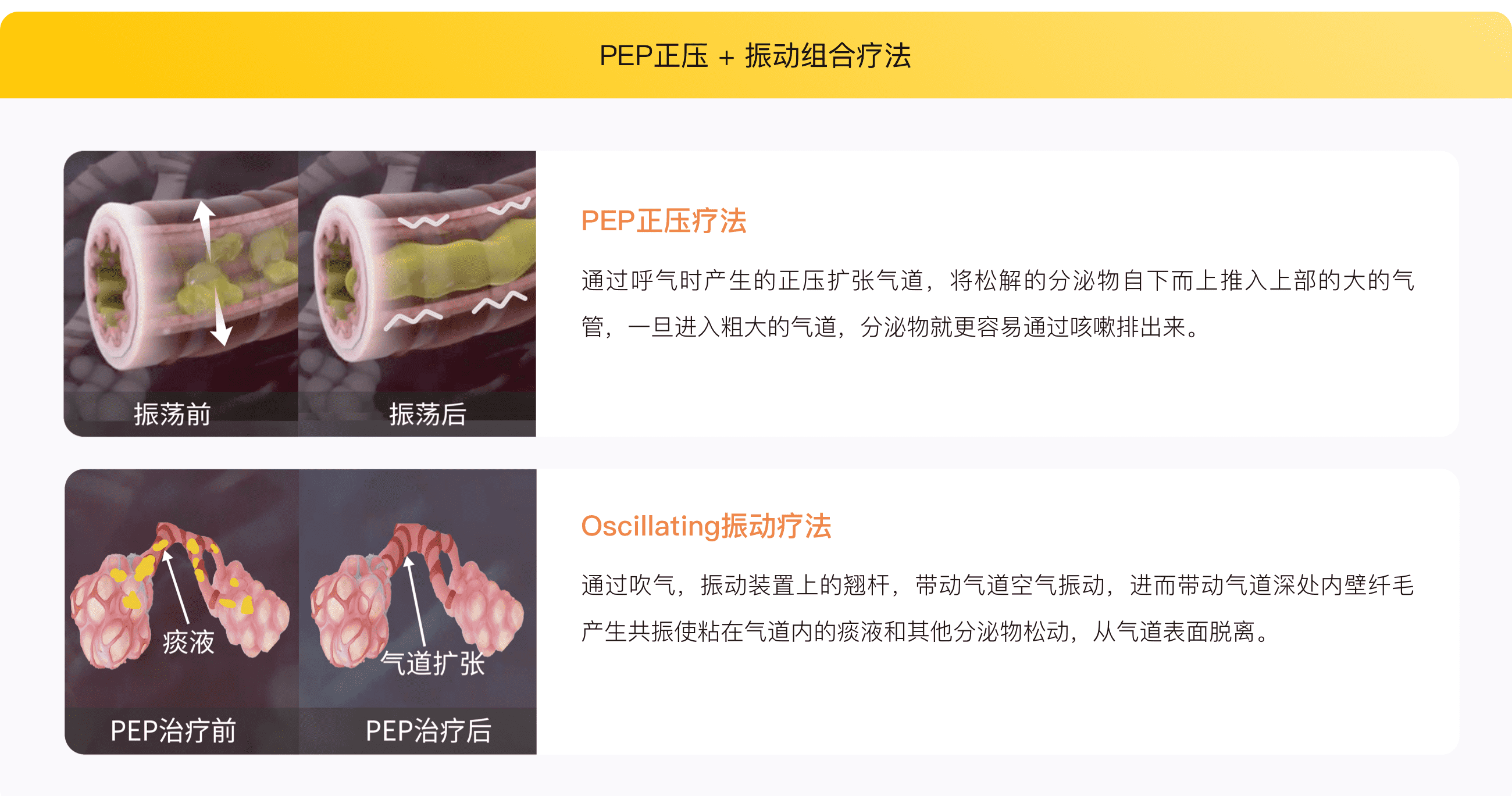 呼吸训练